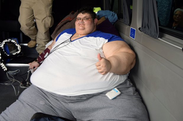 ชมคลิปทีมแพทย์เม็กซิโก เตรียมผ่าตัดลดขนาดกระเพาะอาหารให้กับชายที่อ้วนสุดในโลก