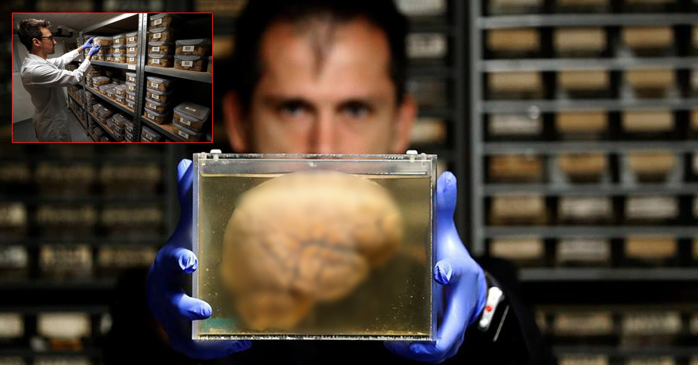 คลังสมองมนุษย์ 3,000 ก้อนที่ถูกเก็บในรพ.จิตเวช ประเทศเบลเยียม