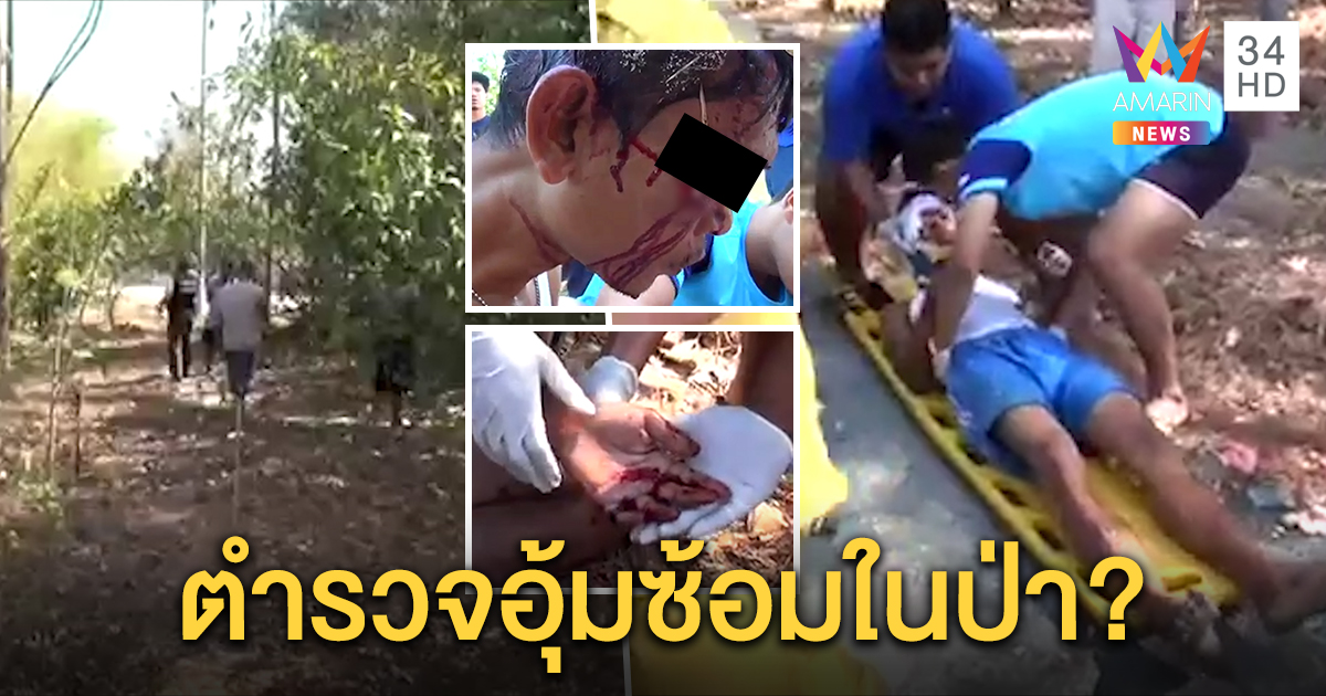 หนุ่มถูกฟันหน้าเลือดอาบ อ้างตำรวจเอาถุงคลุมหัว อุ้มซ้อมในป่า แกล้งตายเลยรอด