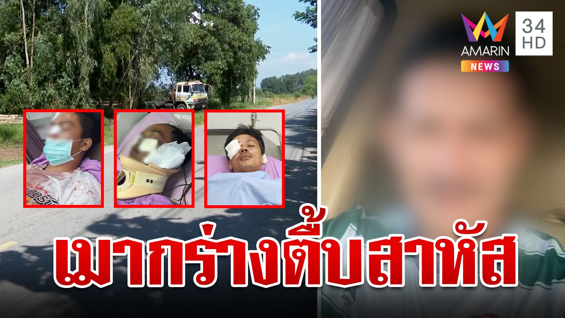 แฉ "นายกฯ อบต." เมากร่างตื้บวัยรุ่น หนุ่มใหญ่โร่แจงปัดทำร้าย | ทุบโต๊ะข่าว | 11 ต.ค. 67 | AMARIN TVHD34