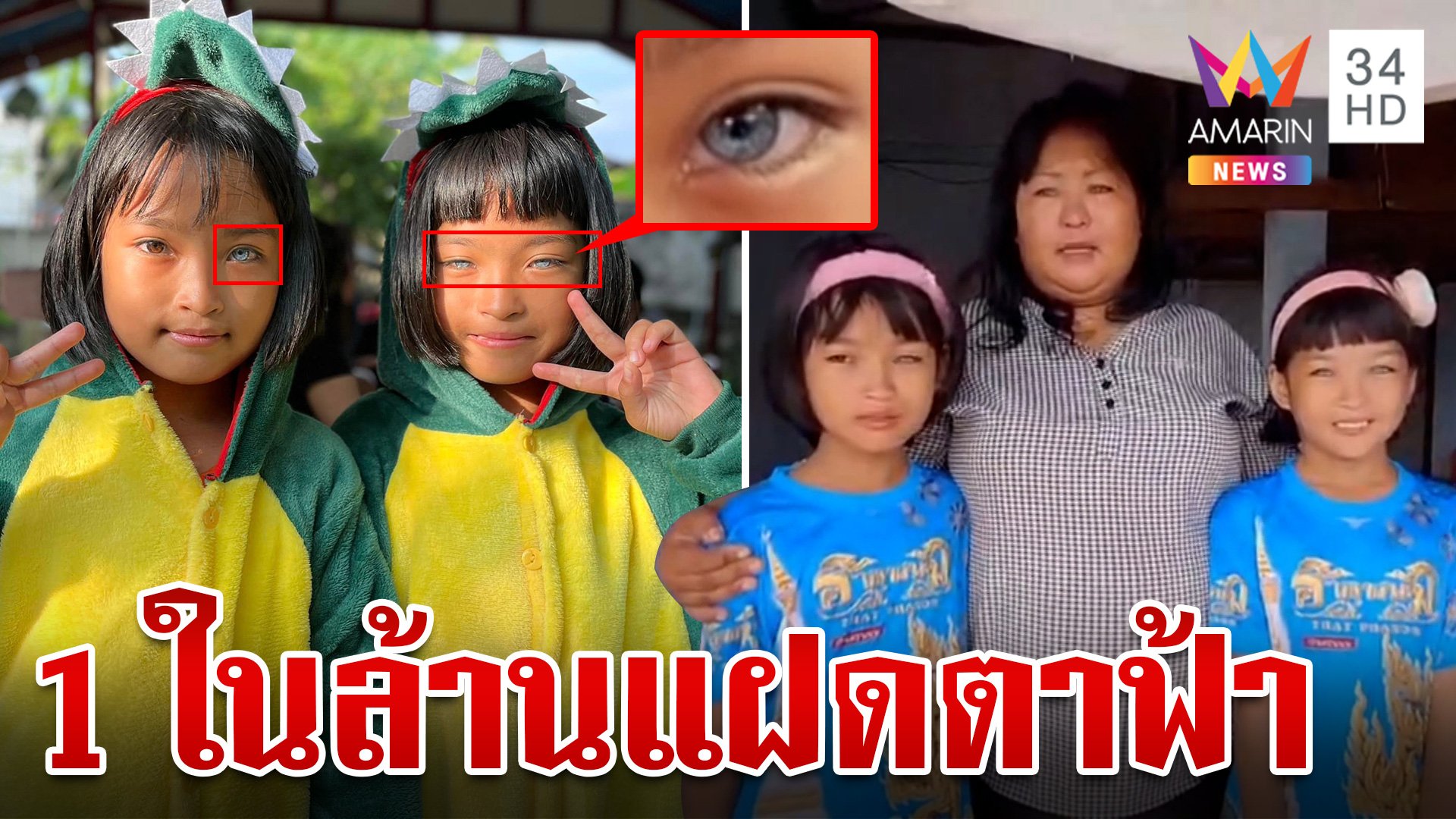 ชะตาอาภัพ! เด็กแฝดตาฟ้า-พิการทางหู แม่เผยโรคพันธุกรรม | ทุบโต๊ะข่าว | 5 พ.ย. 67 | AMARIN TVHD34