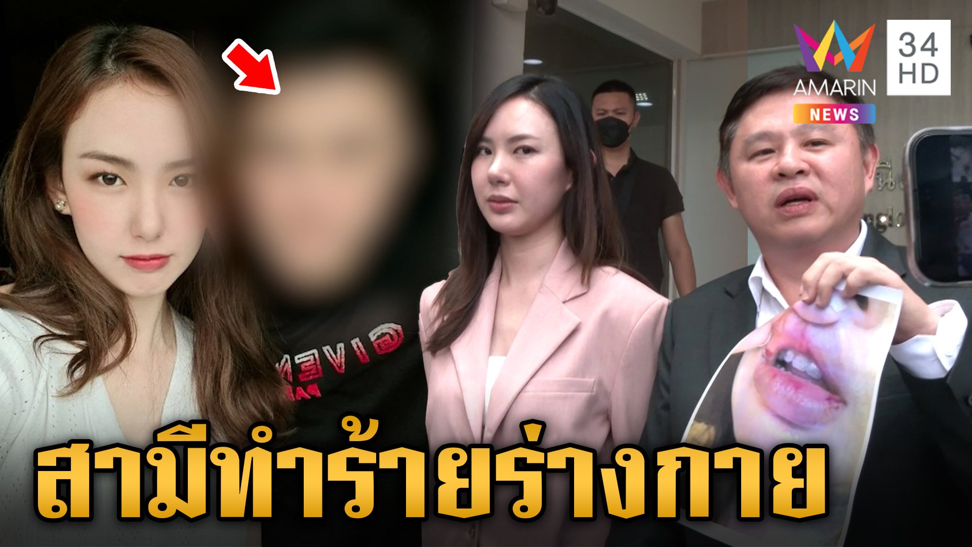 เชอรีนน้ำตาตกแจ้งความอดีตสามีคุกคาม-ทำร้ายร่างกาย   | ข่าวเย็นอมรินทร์ | 23 ก.ค. 67 | AMARIN TVHD34