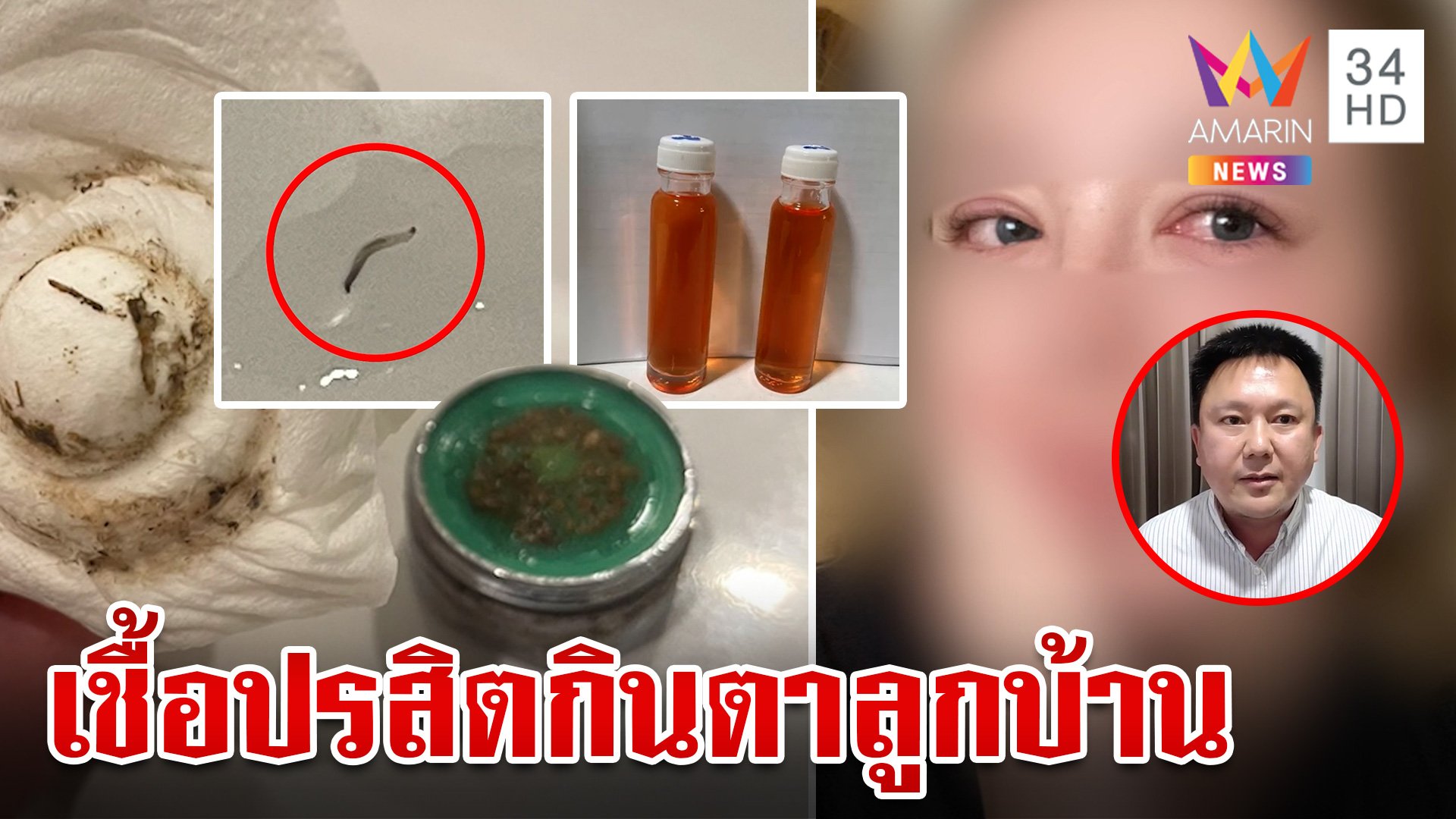 สยองทั้งคอนโด!ปรสิตในน้ำกินตาลูกบ้านนับ 100  บางรายหวิดตาบอด | ทุบโต๊ะข่าว | 9 ก.ค. 67 | AMARIN TVHD34