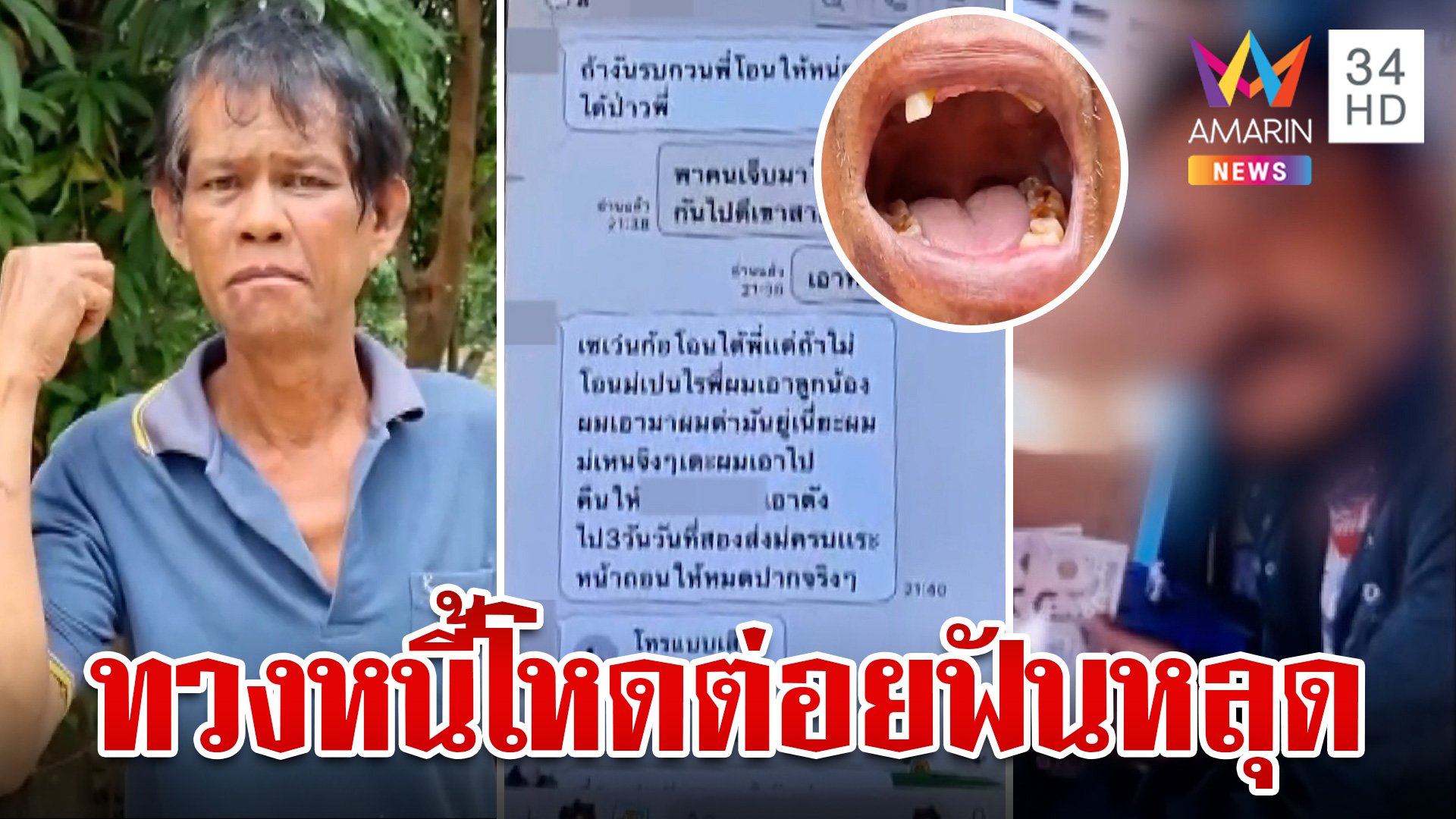 เถื่อน!แก๊งทวงหนี้สุดโหด ต่อยลุงฟันหลุด 5 ซี่ ยึดทีวี -มือถือ | ทุบโต๊ะข่าว | 16 พ.ค. 67 | AMARIN TVHD34