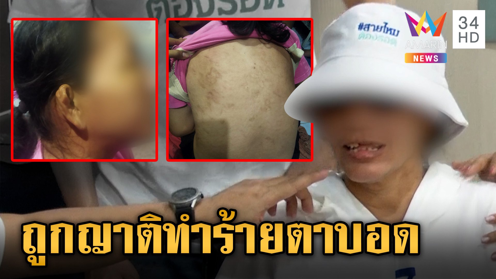 สาวใหญ่ร้องถูกญาติทารุณจนตาบอด ซ้ำหลอกไปเปิดบัญชีม้าจนถูกดำเนินคดี | ข่าวเย็นอมรินทร์ | 21 มิ.ย. 67 | AMARIN TVHD34