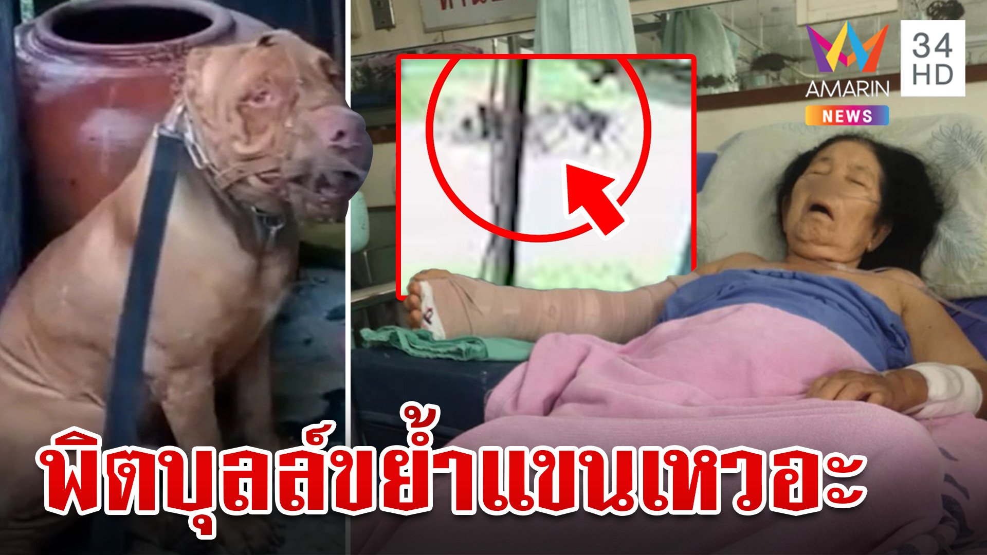 สยอง!พิตบุลล์ขย้ำแขนยายหวิดขาด เผยเคยกัดคนมาแล้ว 5 ครั้ง | ทุบโต๊ะข่าว | 25 มิ.ย. 67 | AMARIN TVHD34