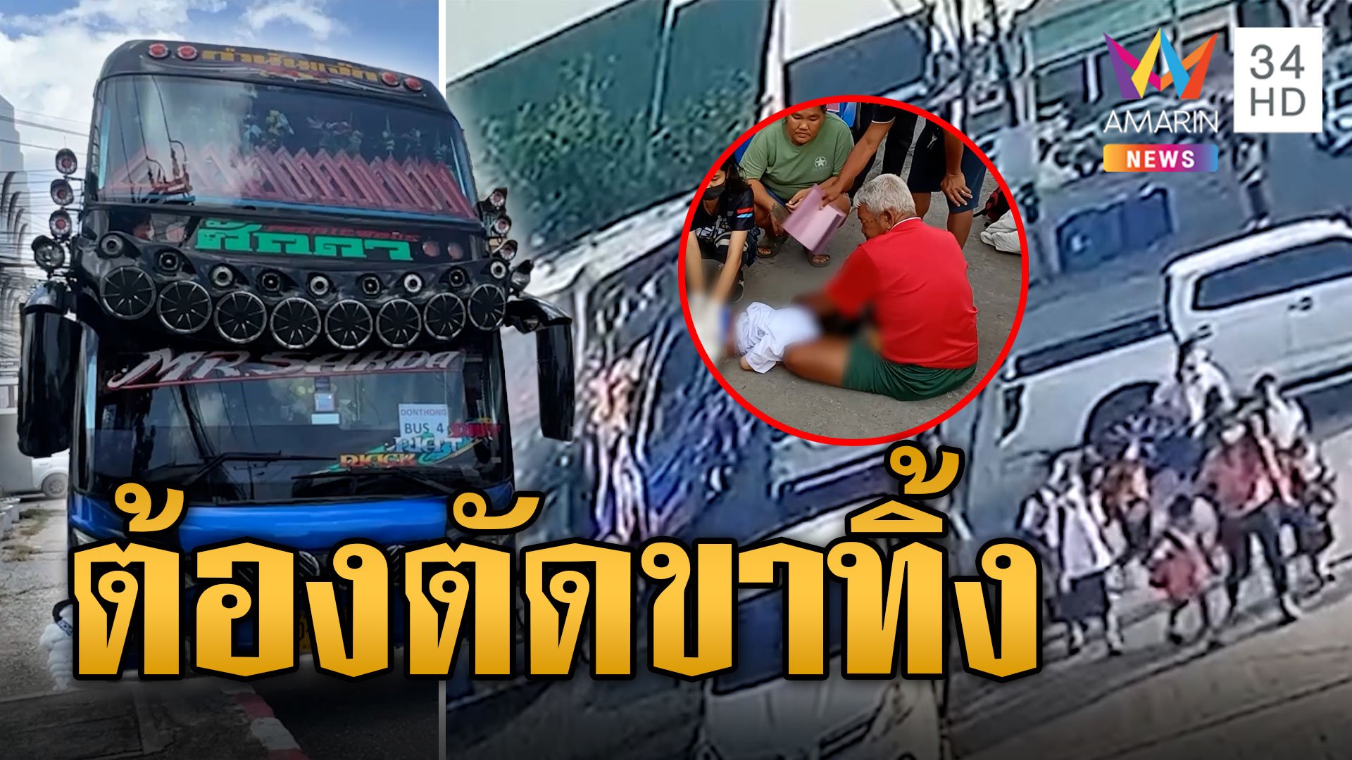 สลด! รถทัวร์ทัศนศึกษาทับขานักเรียน ป.3 หมอบอกต้องตัดขาถึงสะโพก | ข่าวอรุณอมรินทร์ | 9 ส.ค. 66 | AMARIN TVHD34