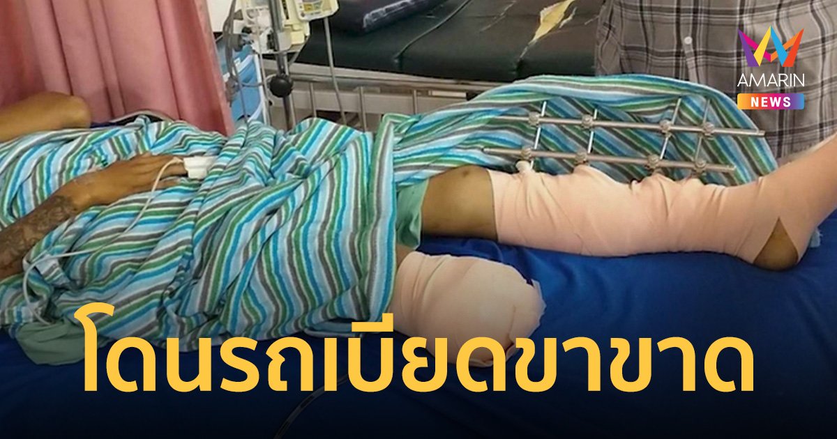 จี้เอาผิดคนขับกระบะ คิดว่าเป็นอริลูกชาย พุ่งเบียดลงข้างทางจนขาขาด