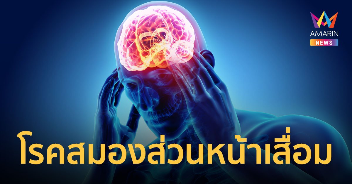 ทำความรู้จัก โรคสมองส่วนหน้าเสื่อม Frontotemporal dementia