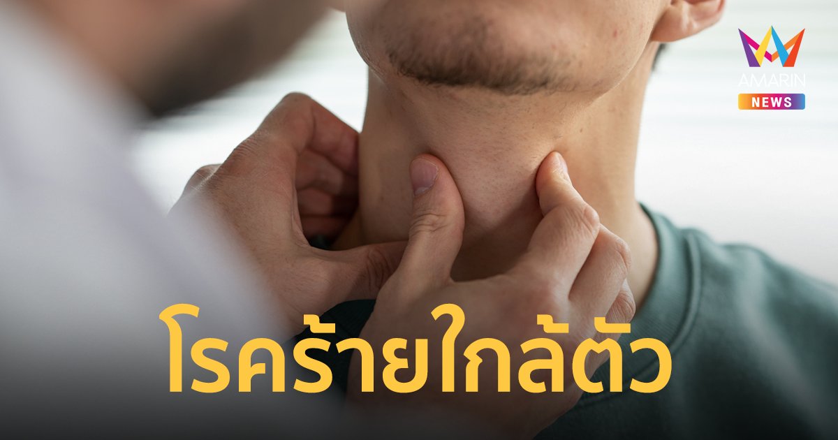 รู้จัก “มะเร็งต่อมน้ำเหลือง” 1 ใน 10 ของมะเร็งที่พบบ่อยในคนไทย 