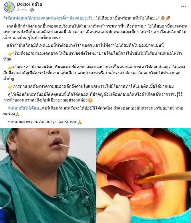 เตือนภัย ! ไม้เสียบลูกชิ้น ห้ามดึงออกเองเด็ดขาด