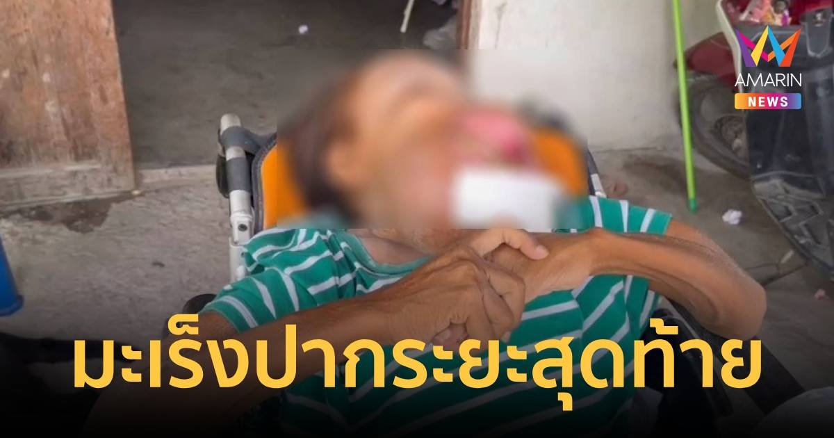 สุดรันทด!สาวป่วยมะเร็งปากระยะสุดท้าย แต่หัวใจยังสู้