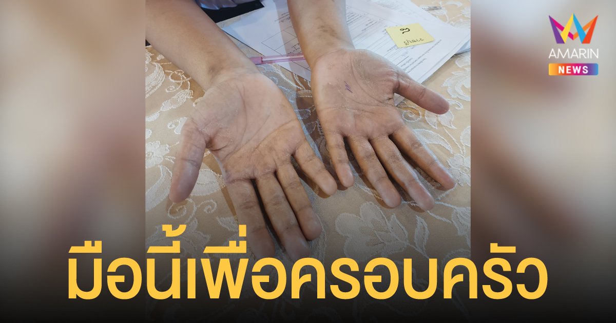 อาจารย์เผยภาพมือนักเรียน ม.6 มาสอบพยาบาล สะดุดตาและประทับใจในความเสียสละ