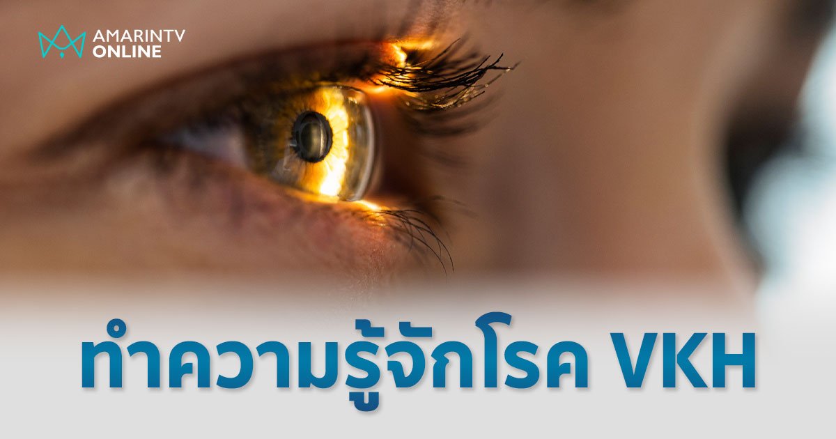 VKH หนึ่งในโรคจอประสาทตาอักเสบ ทำไมถึงสูญเสียการมองเห็น