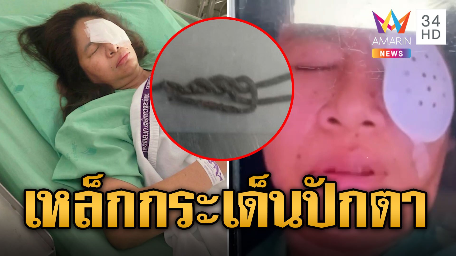 หนุ่มตัดหญ้า ทำเหล็กกระเด็นปักตาสาว จอดรถรอไฟแดง | ข่าวอรุณอมรินทร์ | 12 ส.ค. 67 | AMARIN TVHD34