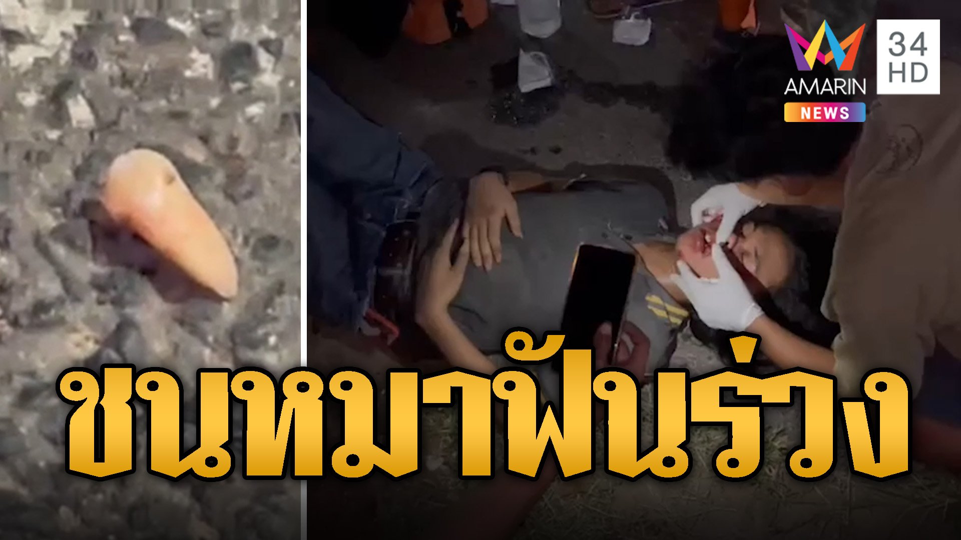 หนุ่มซิ่งชนหมา ฟันร่วง 1 ซี่โชคดีไม่ตาย | ข่าวอรุณอมรินทร์ | 9 ก.ย. 67 | AMARIN TVHD34