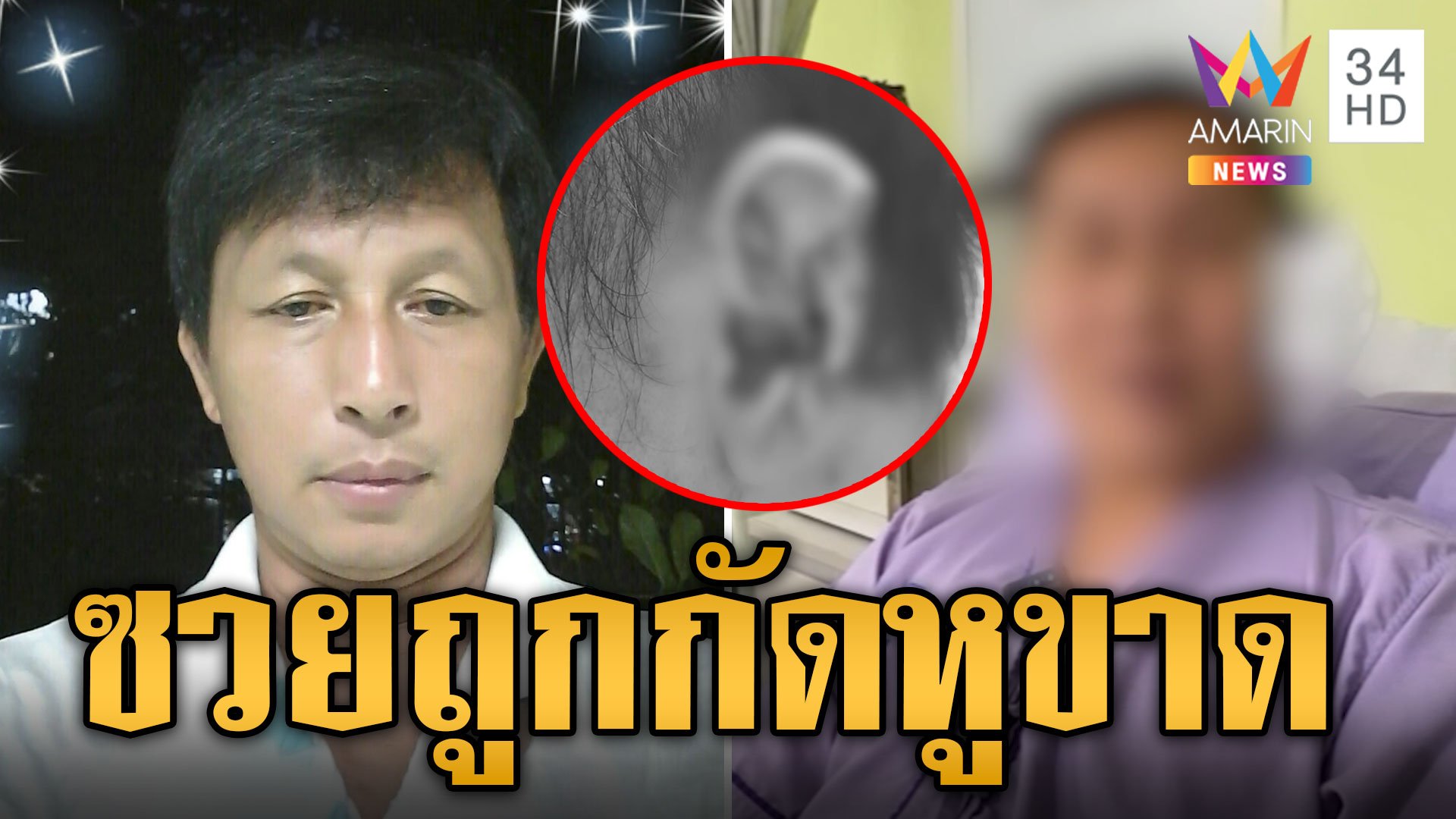 หนุ่มใหญ่ซวย! ห้ามศึกพี่สาวทะเลาะพี่เขย ถูกกัดหูขาด | ข่าวเที่ยงอมรินทร์ | 18 ก.ย. 67 | AMARIN TVHD34