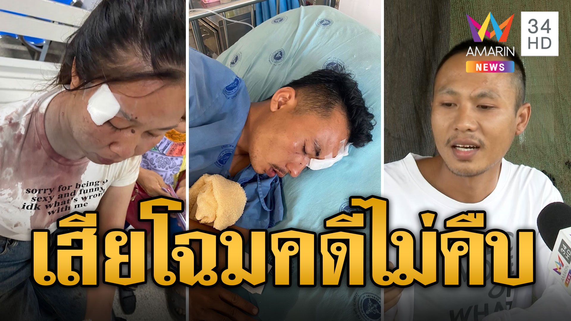 สาวถูกขวดฟาดหน้าเสียโฉม คดีไม่คืบ เอาผิดคนทำไม่ได้ | ข่าวเที่ยงอมรินทร์ | 13 ก.ค. 67 | AMARIN TVHD34