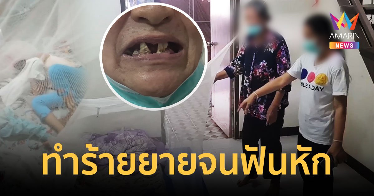 หดหู่!หลานออทิสติกหิวข้าว ทำร้ายยายวัย69ปีเลือดออก-ฟันหัก