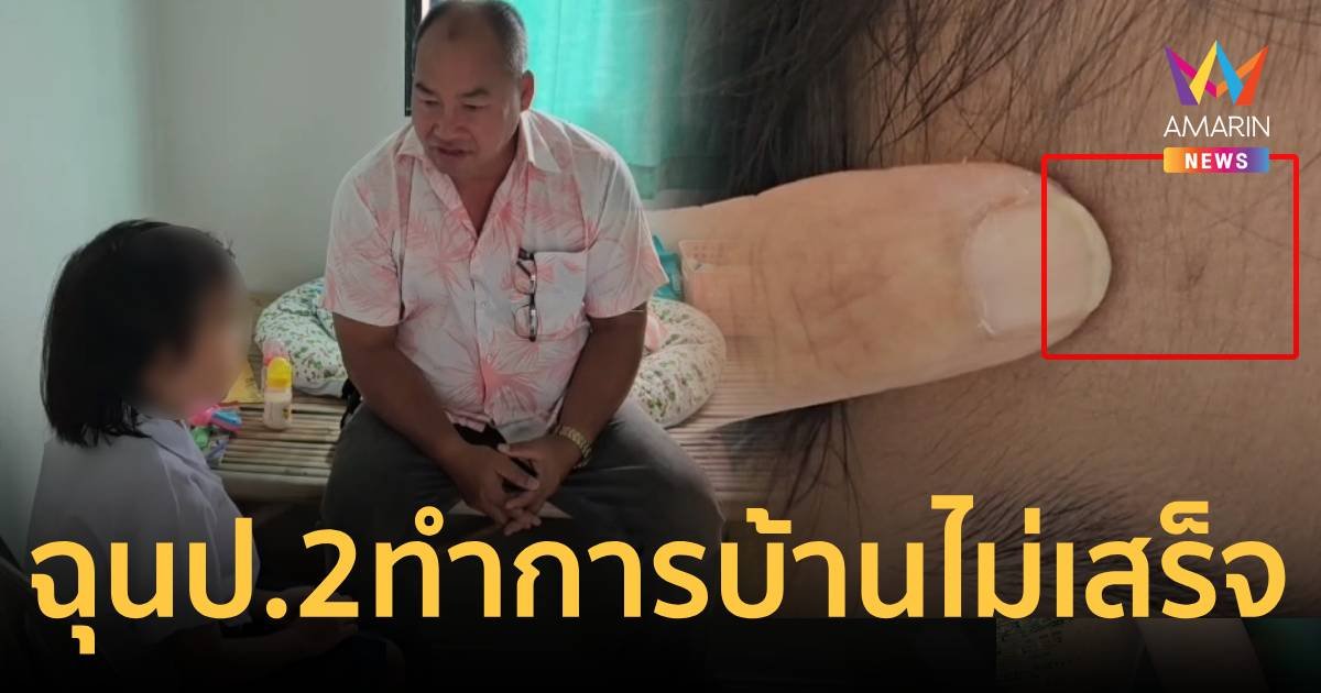 ครูฉุนเด็กป.2ทำการบ้านไม่เสร็จ  หลังแหวนเขกหัวจนเป็นแผล