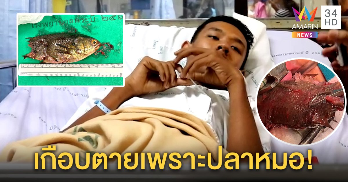 อุทาหรณ์! คนงานพม่าคาบปลาหมอในปาก หลุดติดคอเกือบตาย โชคดีหมอช่วยทัน