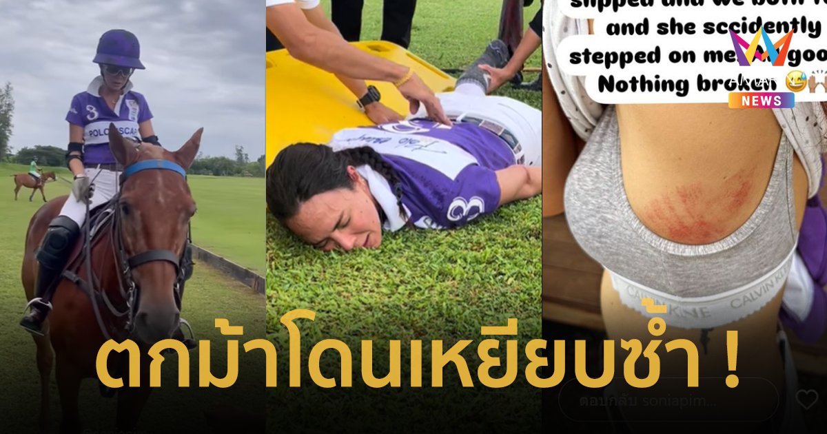 "พิม ซอนย่า" สปิริตแรงไปทำงานแล้ว หลังเกิดอุบัติเหตุตกม้า โดนเหยียบซ้ำ