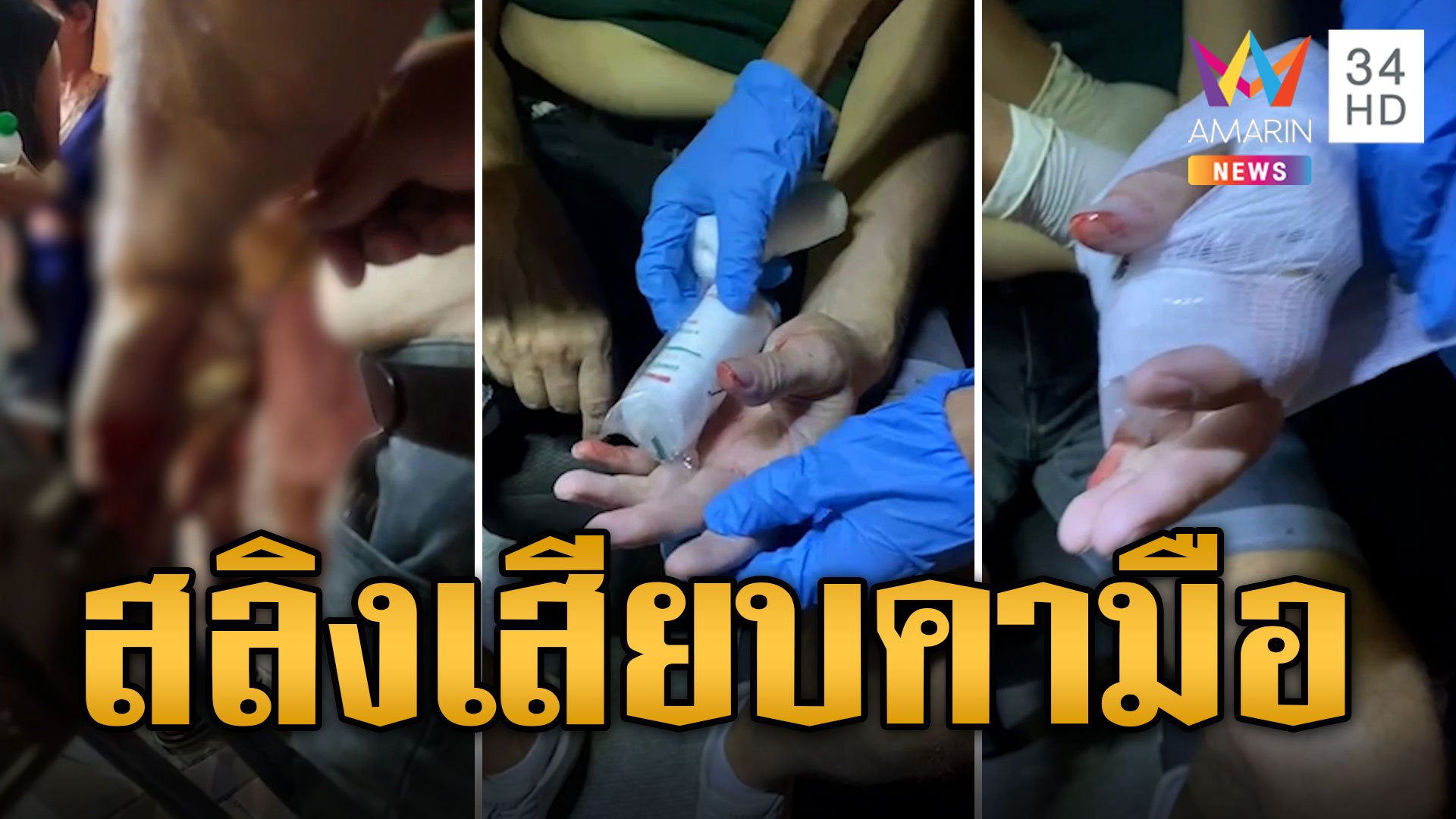 นทท.ซวย สะดุดล้มถูกสลิงขึงสายไฟเสียบมือเลือดอาบ | ข่าวเที่ยงอมรินทร์ | 1 ธ.ค. 66 | AMARIN TVHD34