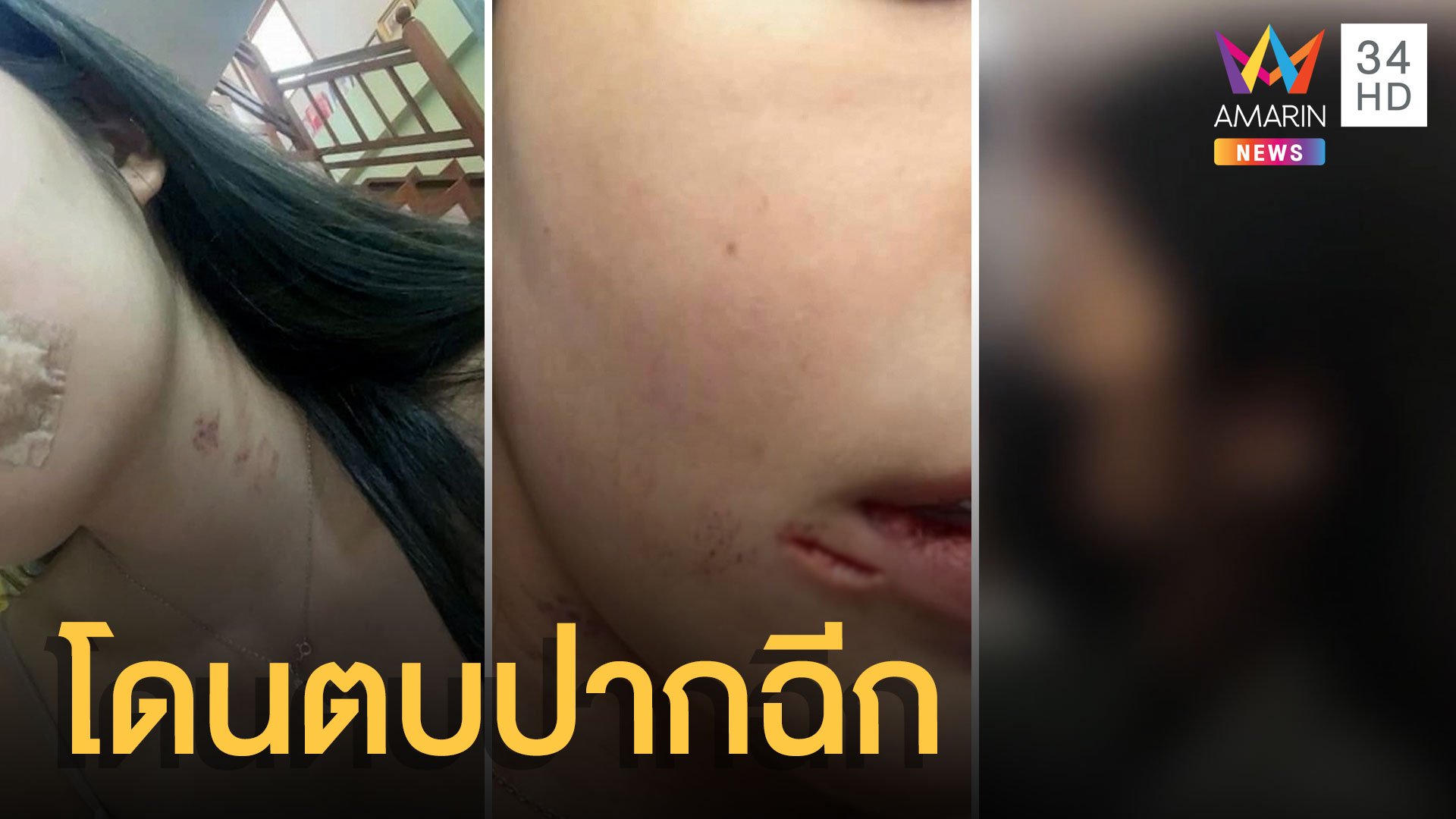 หนุ่มหึงโหด ตบแฟนพริตตี้ปากฉีก ซ้ำขู่ห้ามแจ้งความ | ข่าวเที่ยงอมรินทร์ | 16 มี.ค. 64 | AMARIN TVHD34