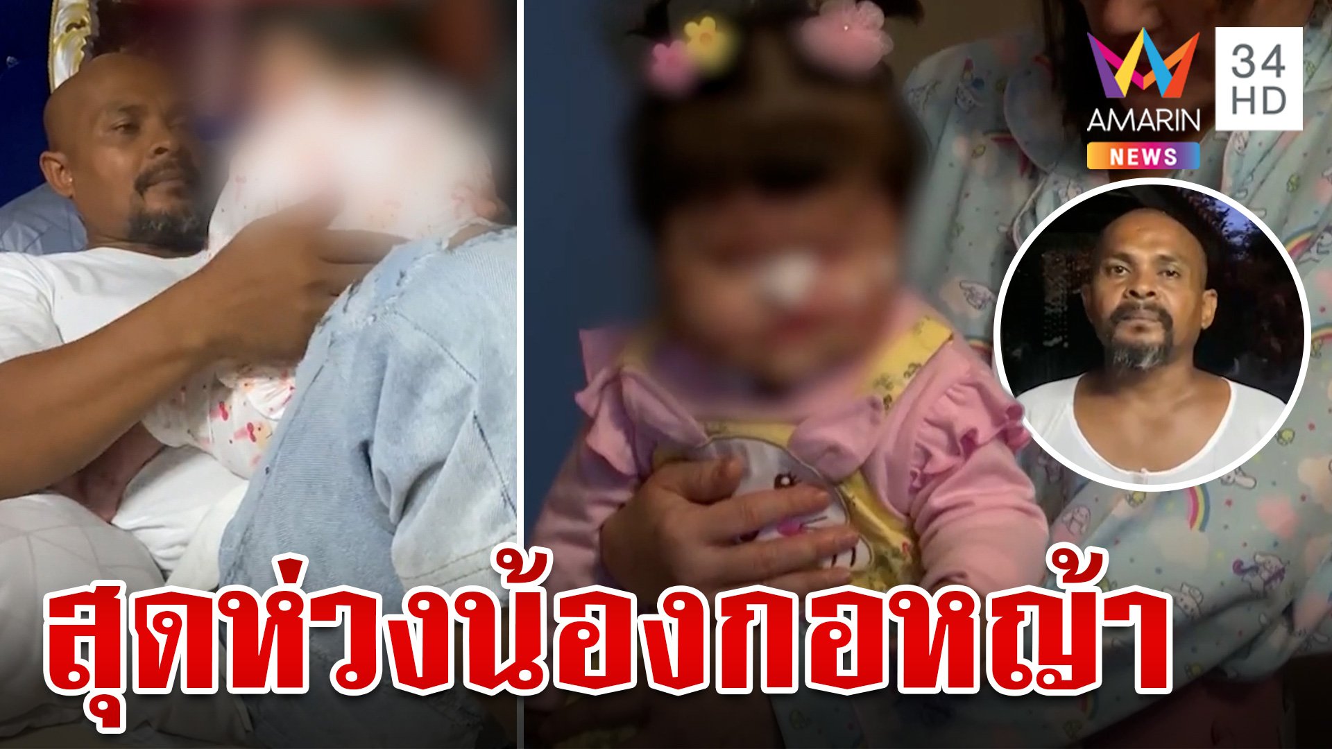 "หมอปลา" สุดห่วงพา "น้องกอหญ้า" ผ่าตัดด่วน ล่าสุดออก รพ.แล้ว | ทุบโต๊ะข่าว | 3 ส.ค. 67 | AMARIN TVHD34