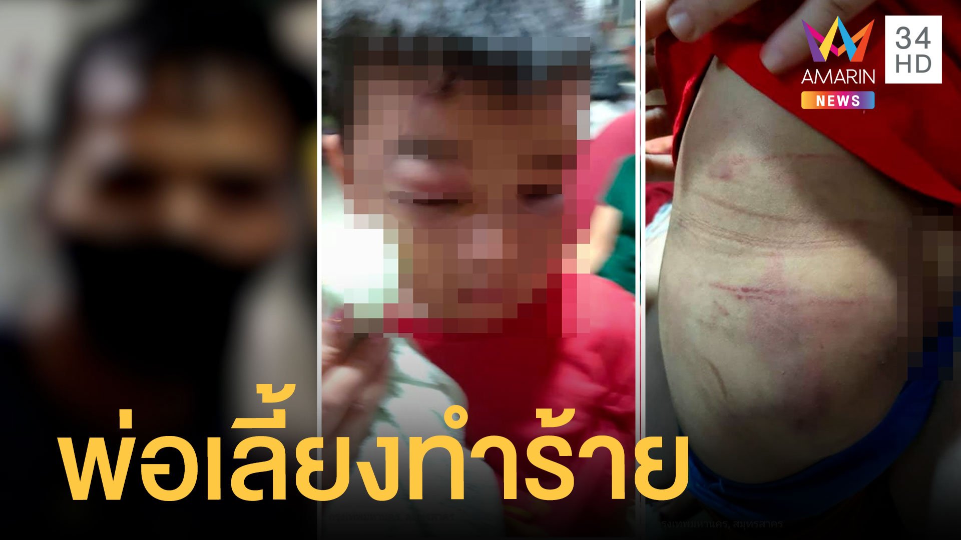 ฮือช่วยเด็ก 6 ขวบถูกพ่อเลี้ยงตบตีจนตาปูด | ข่าวเที่ยงอมรินทร์ | 14 ก.ค. 64 | AMARIN TVHD34