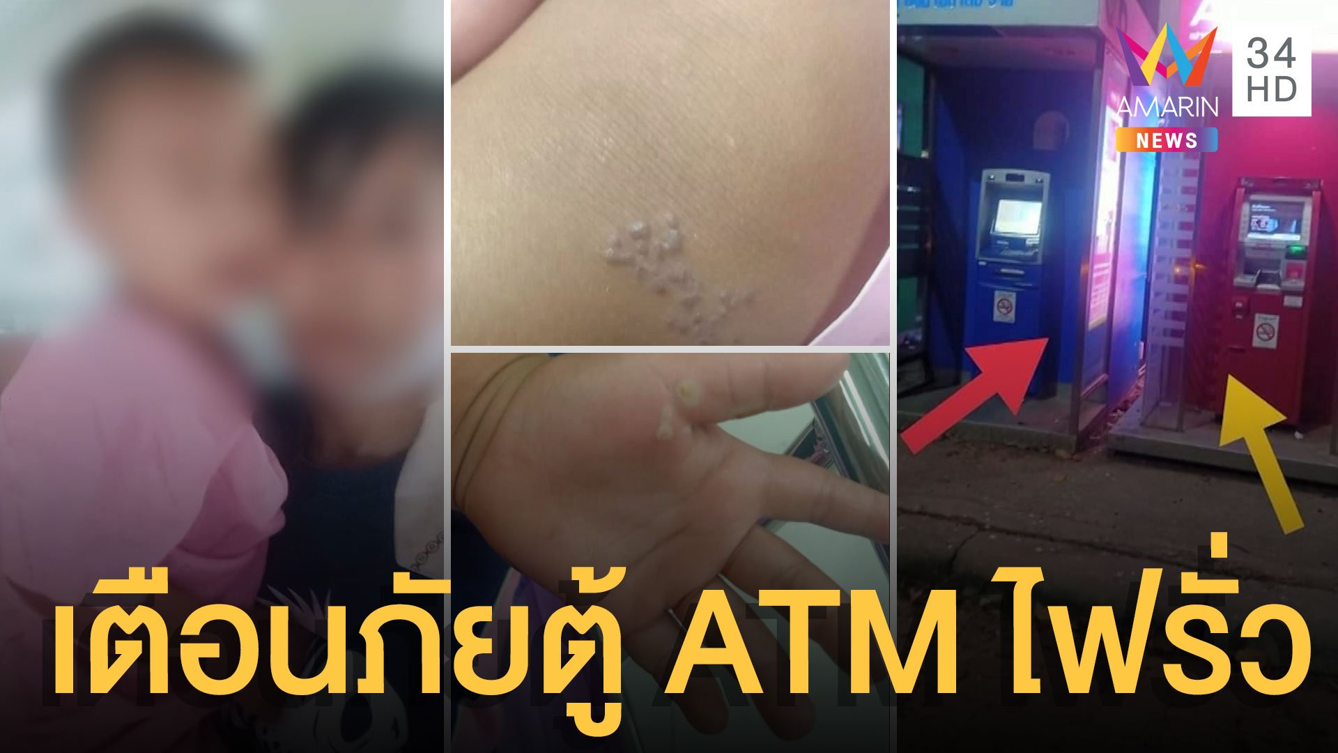 เตือนภัยตู้ ATM ไฟรั่ว แม่โพสต์ลูกโดนไฟดูดหัวใจหยุดเต้น | ข่าวอรุณอมรินทร์ | 15 พ.ย. 64 | AMARIN TVHD34