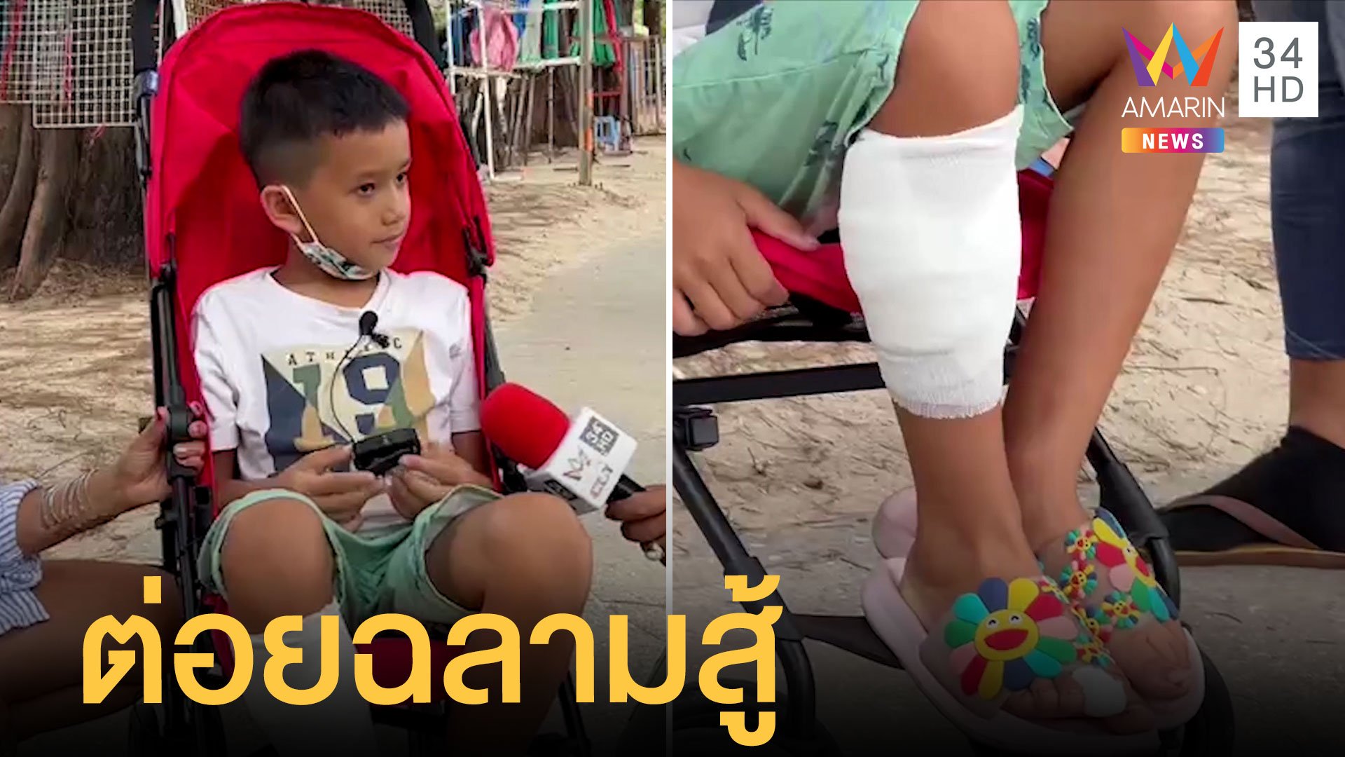 เด็ก 8 ขวบ โดนปลาฉลามหัวบาตรกัดขาฮึดต่อยสู้ | ข่าวอรุณอมรินทร์ | 3 พ.ค. 65 | AMARIN TVHD34