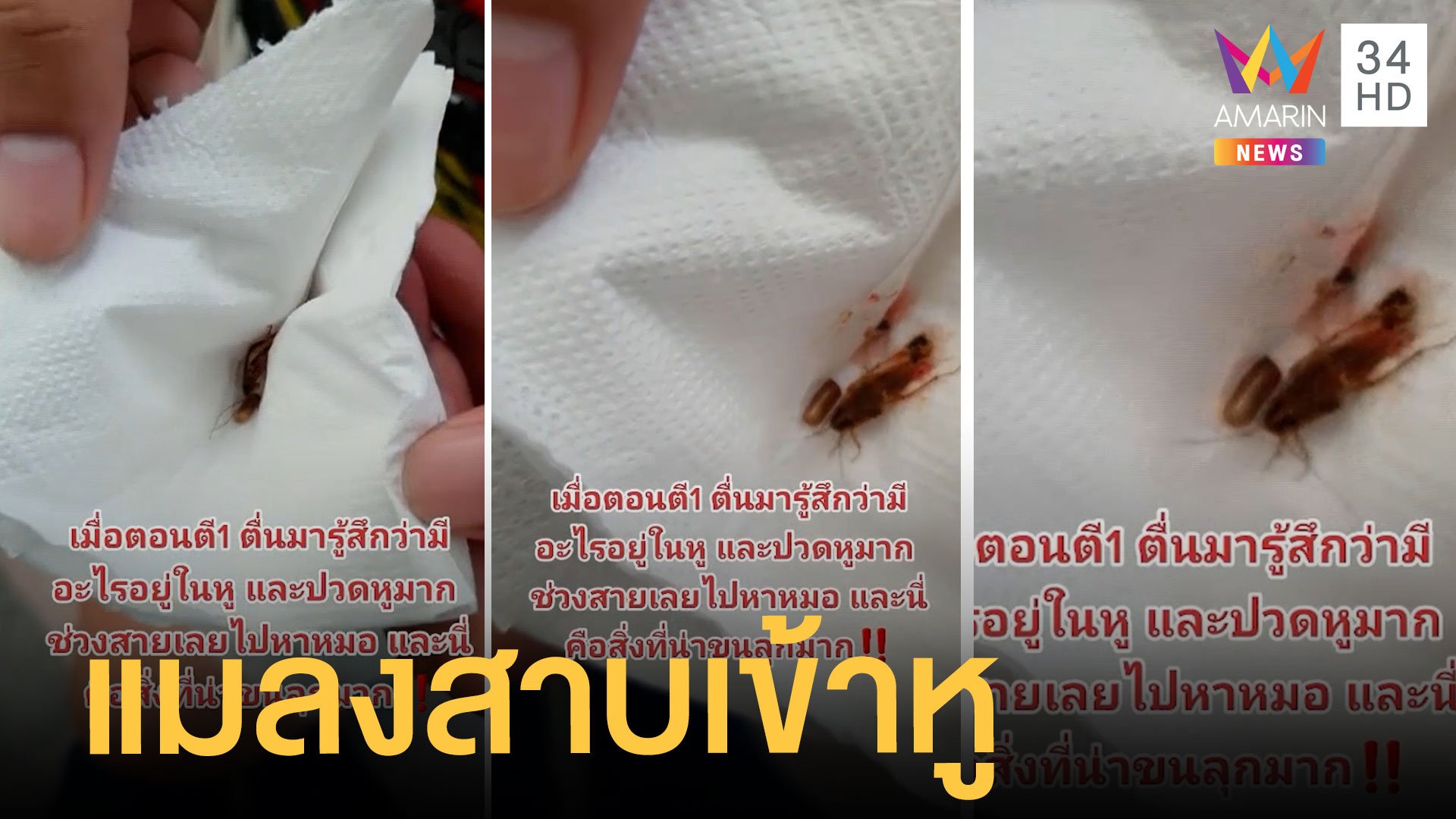 คันหูไม่รู้เป็นอะไร ไปหาหมอถึงกับอึ้ง แมลงสาบตัวใหญ่อยู่ในหู | ข่าวอรุณอมรินทร์ | 31 ส.ค. 64 | AMARIN TVHD34