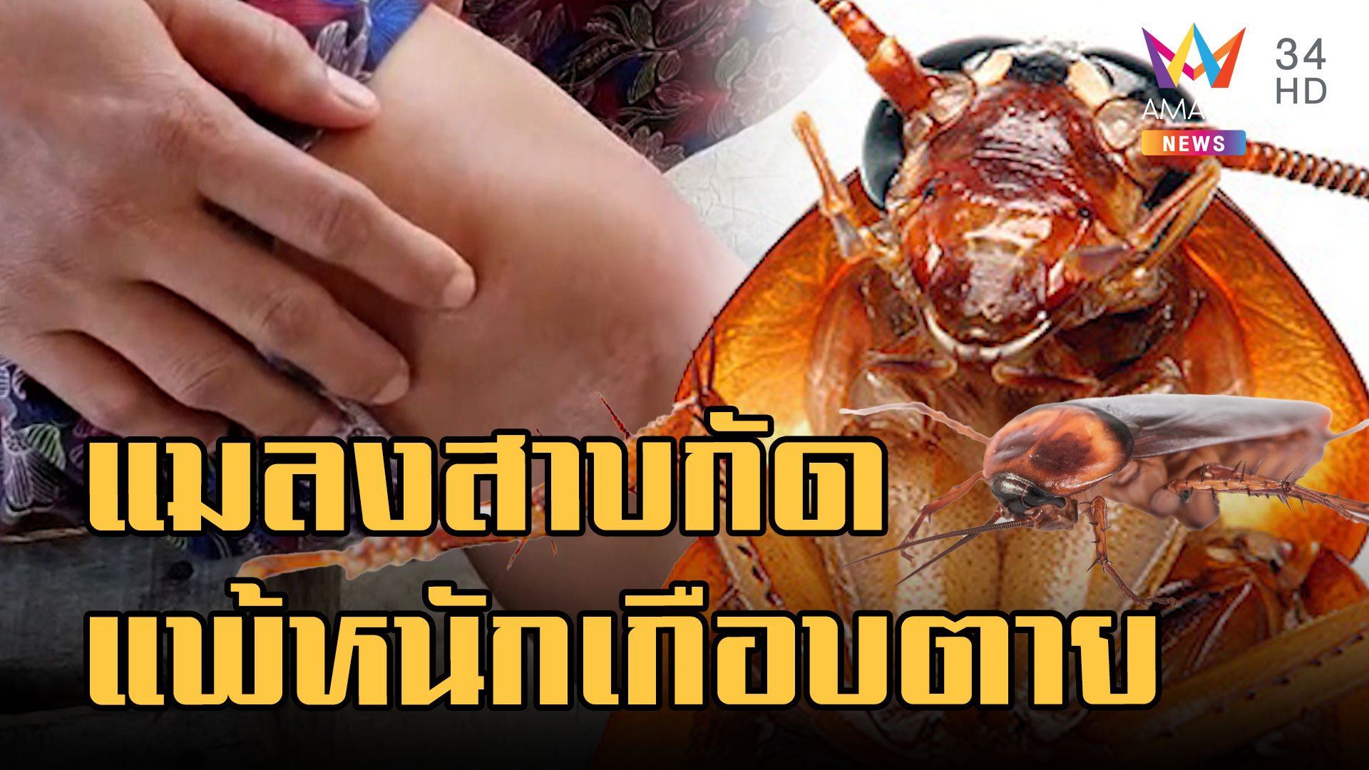 สาวพม่าถูกแมลงสาบกัด แพ้หนักเกือบตาย โทรแจ้งกู้ภัยยังไม่เชื่อ | ข่าวอรุณอมรินทร์ | 6 ก.ย. 65 | AMARIN TVHD34