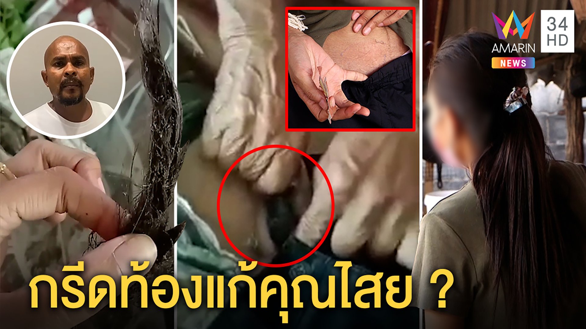 สาวถอนคุณไสยอึ้งเจอกระจุกผมคาท้องแต่ไร้รอยกรีด หมอปลาเชื่อกลมิจฉาชีพ | ทุบโต๊ะข่าว | 27 มี.ค. 64 | AMARIN TVHD34