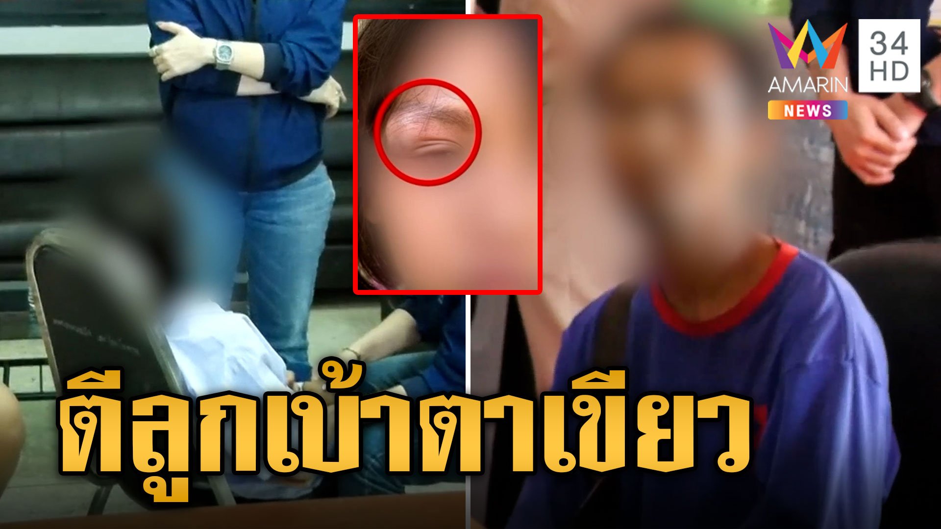 พ่อโหดคว้าไม้ตีลูกสาว 8 ขวบ เบ้าตาเขียวช้ำ ถูกทารุณแผลเต็มทั้งตัว | ข่าวเที่ยงอมรินทร์ | 6 ก.พ. 67 | AMARIN TVHD34