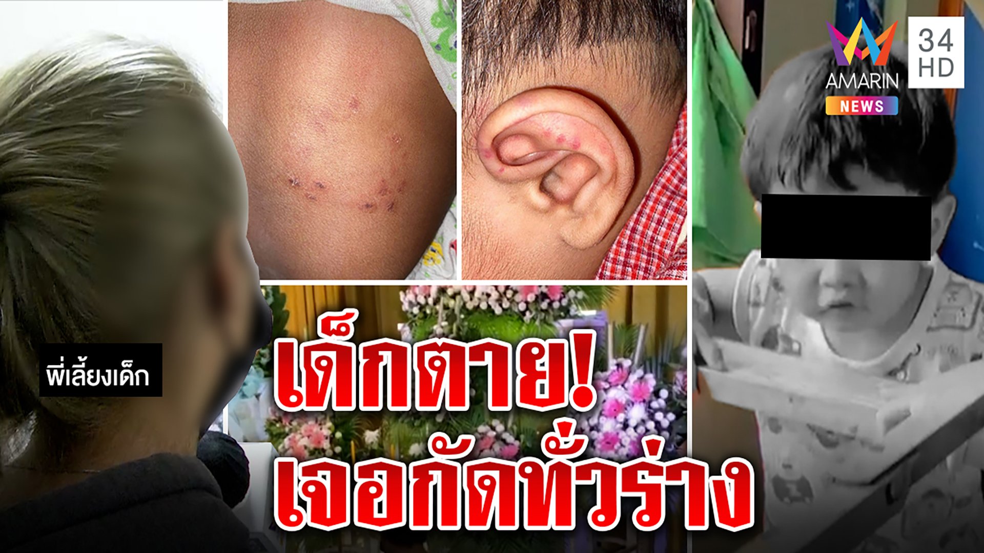 ดับปริศนา! น้องพอร์ชขวบเศษรอยกัดทั่วร่าง พี่เลี้ยงอ้างแมวข่วนจวกฟ้องสื่อทำไม  | ทุบโต๊ะข่าว | 27 ส.ค. 64 | AMARIN TVHD34