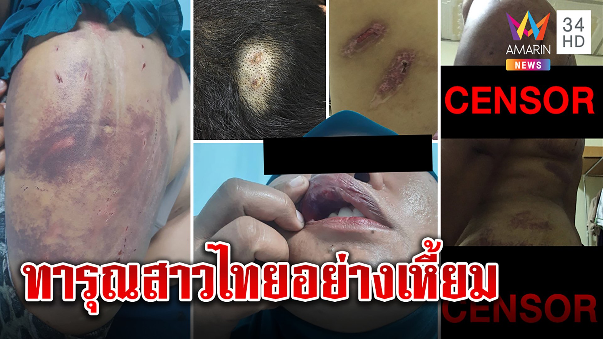 ช็อก! สาวไทยถูกผัวอียิปต์ใช้มีดแทง-ราดน้ำร้อน-ถ่านนาบ เจ็บใกล้ตายแต่ตร.ไม่จับ  | ทุบโต๊ะข่าว | 5 ต.ค. 64 | AMARIN TVHD34