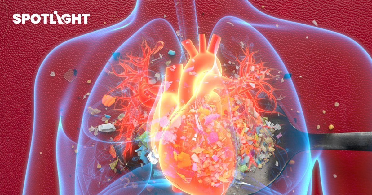 นักวิทย์จีนเจอพลาสติกในเนื้อเยื่อหัวใจมนุษย์ วิจัยชี้อาจทำลายเนื้อเยื่อ ก่อมะเร็งได้