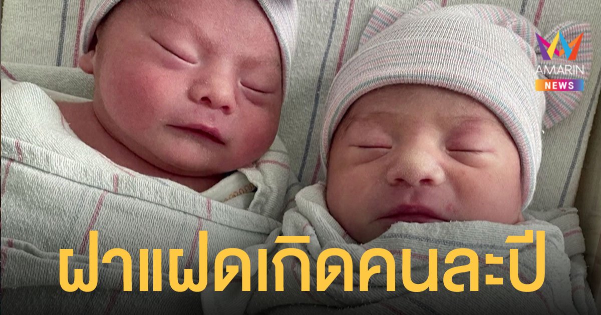 ฝาแฝดชายหญิง เกิดวันที่ 31 ธ.ค.ห่างกัน 15 นาที ได้เกิดคนละปี 