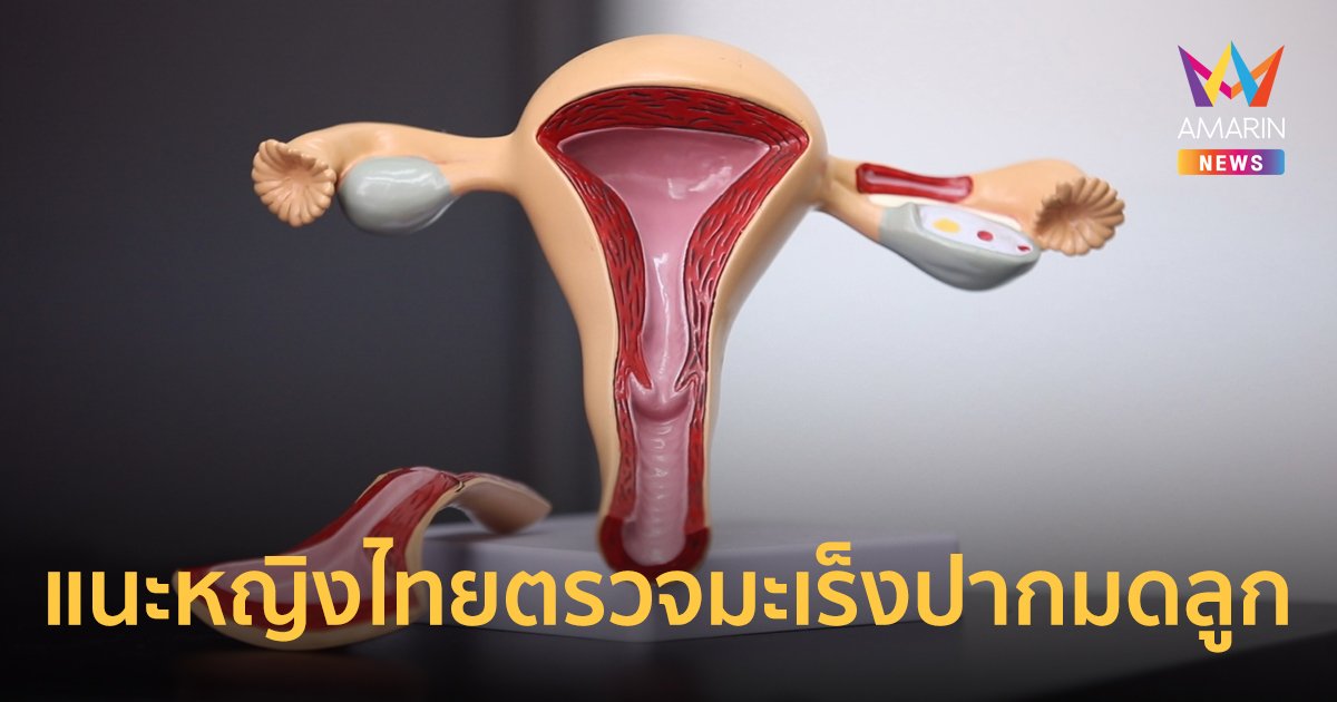 แนะหญิงไทยหมั่นคัดกรองมะเร็งปากมดลูก พบผู้ป่วยสูง 6,000 รายต่อปี