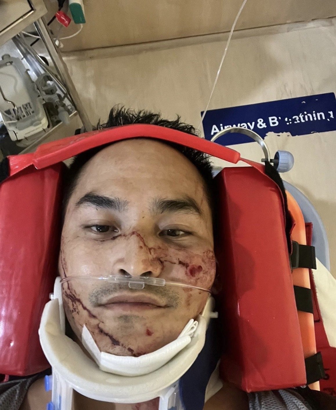 สงกรานต์ เตชะณรงค์  