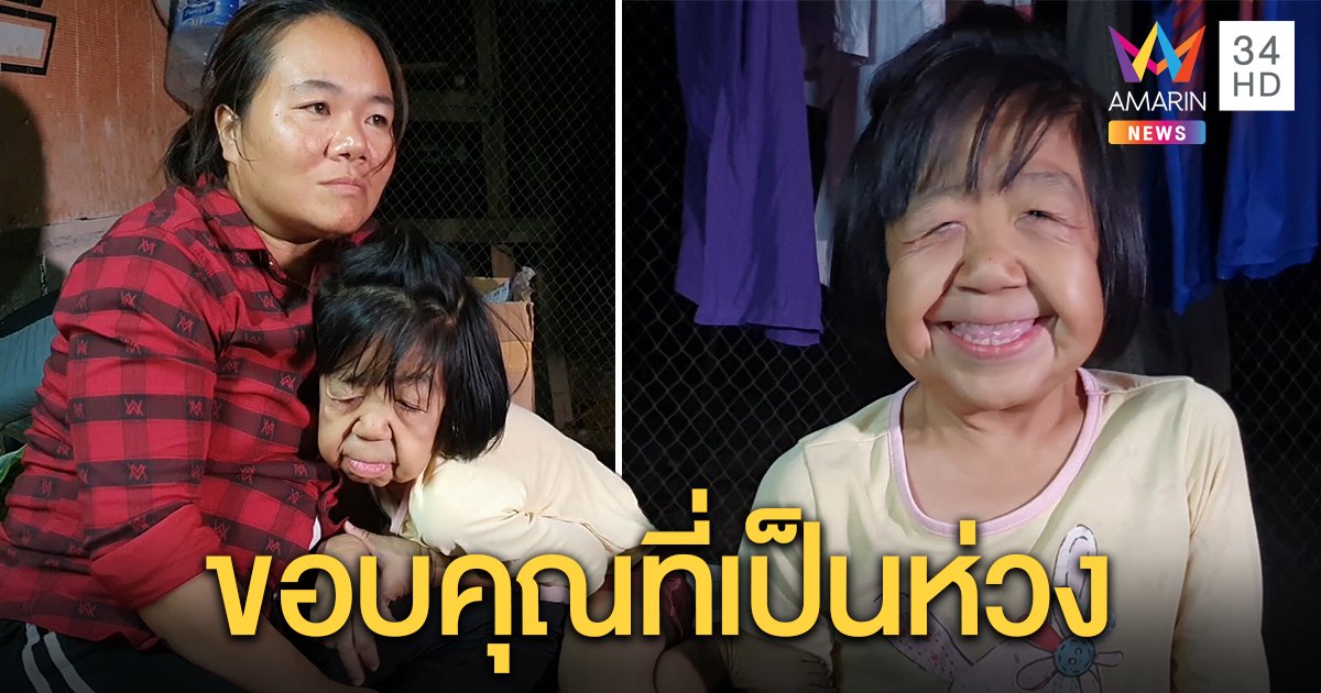 เปิดใจ “น้องเจนนี่” ป่วยหน้าแก่ไม่เศร้าโดนถามจี้ แม่รับโรครุมเร้าห่วงลูกขาดเรียน (คลิป)