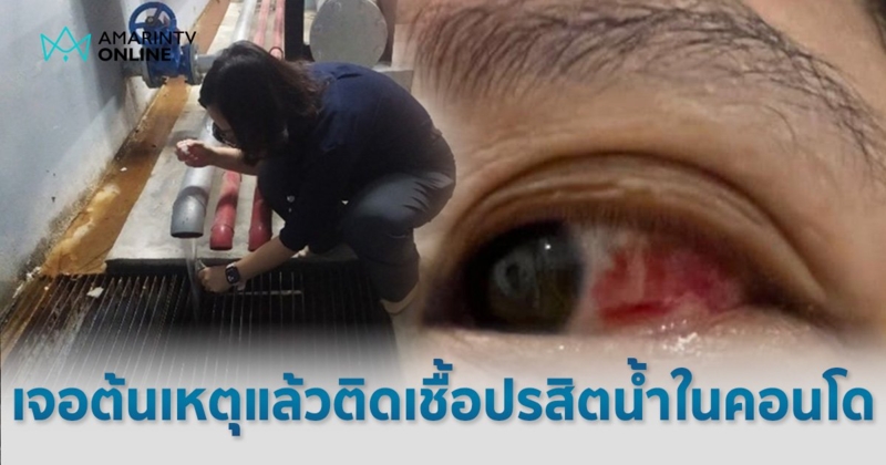 พบสาเหตุแล้ว  ติดเชื้อปรสิตน้ำประปาคอนโด ลูกบ้านป่วย "ตาอักเสบ" 200 ราย