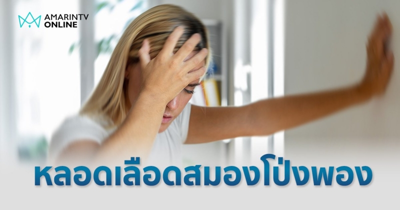 "หลอดเลือดสมองโป่งพอง"  มรดก "โรค" ญาติสายตรง ภัยเงียบไม่แสดงอาการ