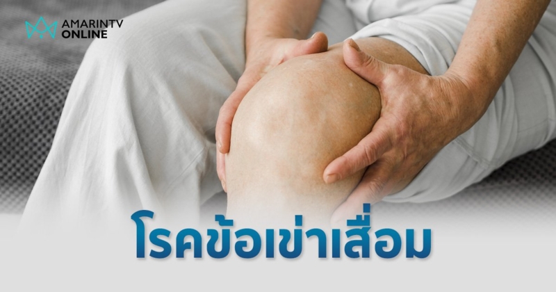 ปวดข้อ เข่าติดขัด บวมแดง อาจเป็น โรคข้อเข่าเสื่อม
