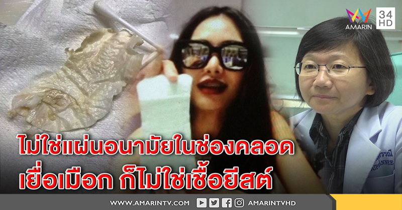 เปิดใจ! สาวเจอเมือกปริศนาในช่องคลอด ปัดไม่ใช่แผ่นอนามัยหลุดคา - หมอชี้ไม่ใช่เชื้อยีสต์ (คลิป)