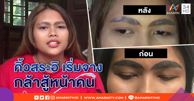 โฉมใหม่! สาวคิ้วสระอิ ยิ้มได้ รอยสักเริ่มจาง กล้าสู้หน้าคน เตือนอย่าสักของถูก (คลิป)