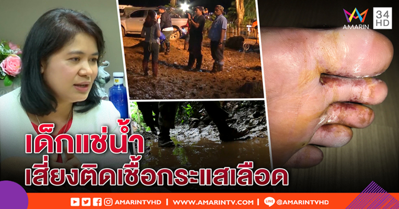 หมอห่วง 13 ชีวิต แช่น้ำถ้ำติดเชื้อกระแสเลือด - จนท. นักข่าว ทรุด น้ำกัดเท้าเล่นงาน (คลิป)