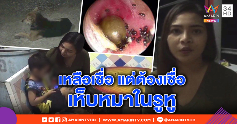 นาทีสยอง! แม่ช็อกเจอเห็บหมาวางไข่ในหูลูก 4 ขวบ เตือนภัยอย่าใกล้หมา - แมวจรจัด (คลิป)